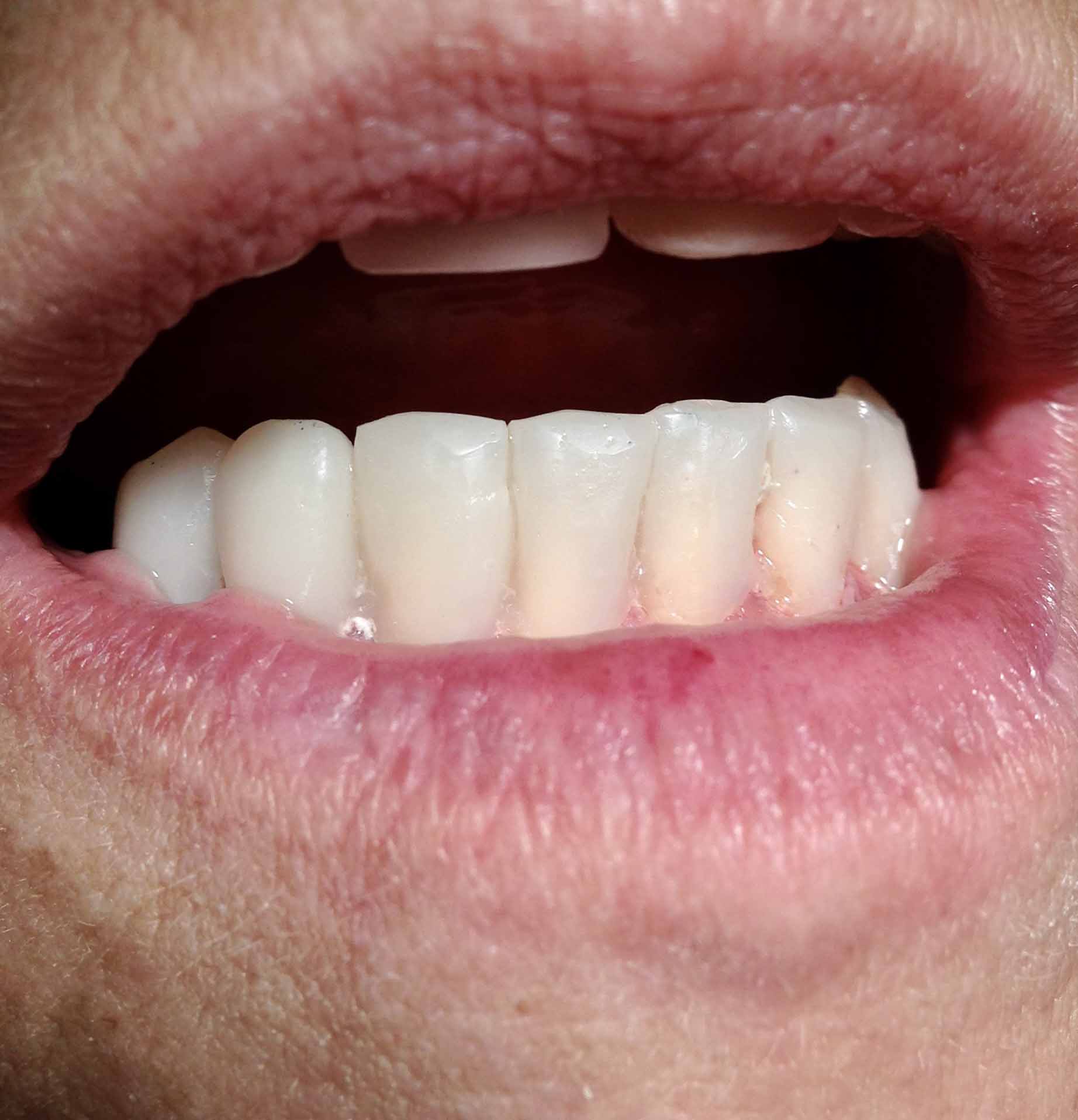 Colorado Springs Dentist Tuttle Family Dentistry